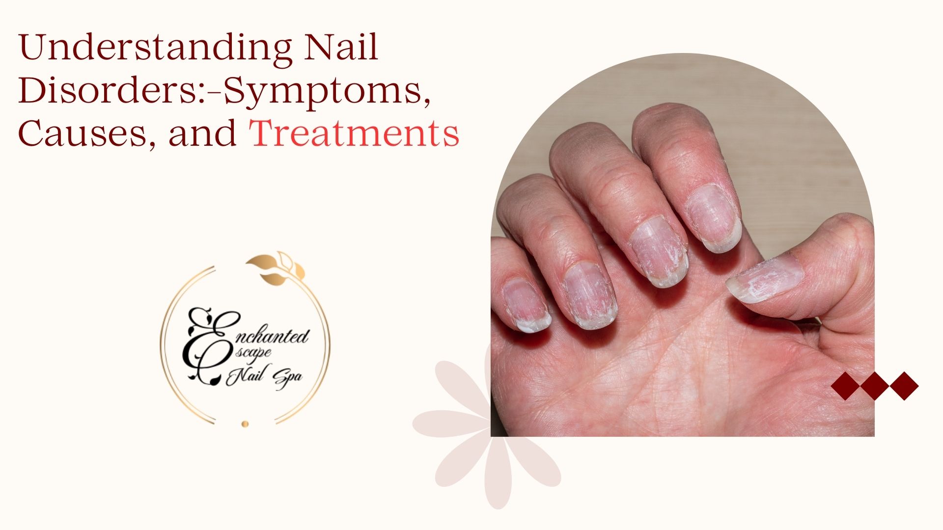 Nail Treatment